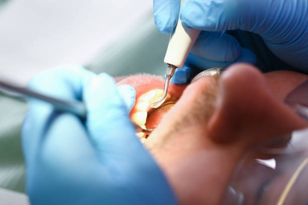 Best Emergency Gum Pain Relief  in Carson City, MI