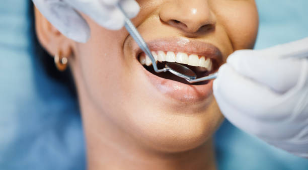 Best Emergency Tooth Extraction  in Carson City, MI