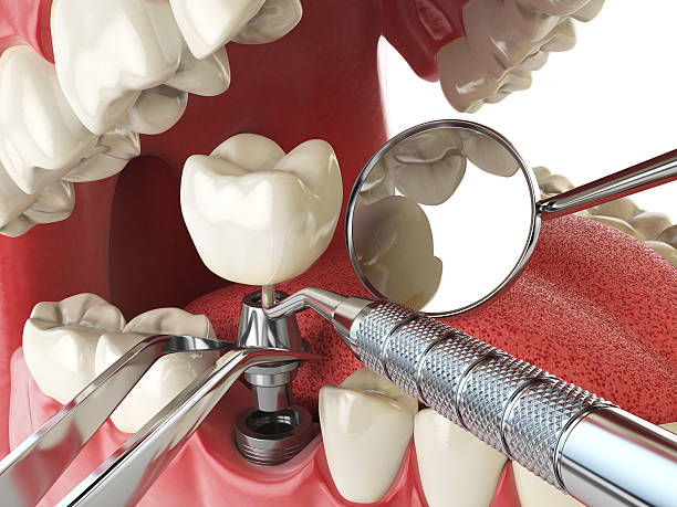 Best Dentist for Severe Toothache  in Carson City, MI